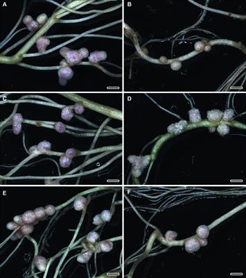 Efficacy of a Plant-Microbe System: Pisum sativum (L.) Cadmium-Tolerant Mutant and Rhizobium leguminosarum Strains, Expressing Pea Metallothionein Genes PsMT1 and PsMT2, for Cadmium Phytoremediation